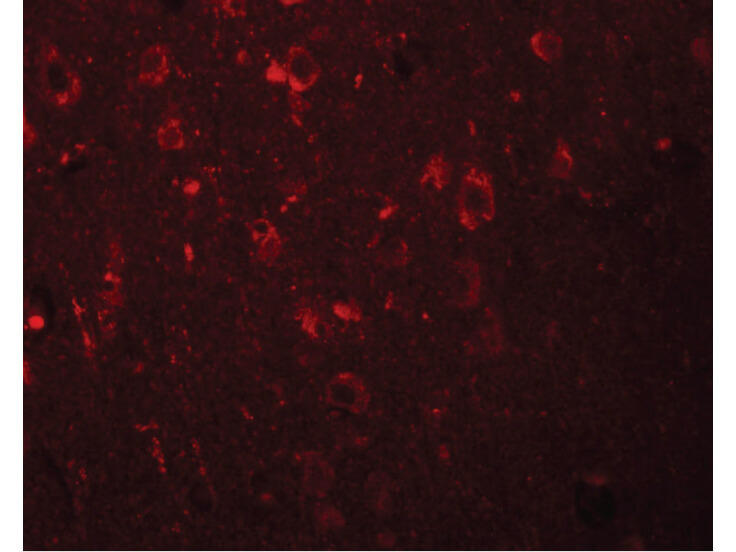 Immunofluorescence of EFHD2 Antibody