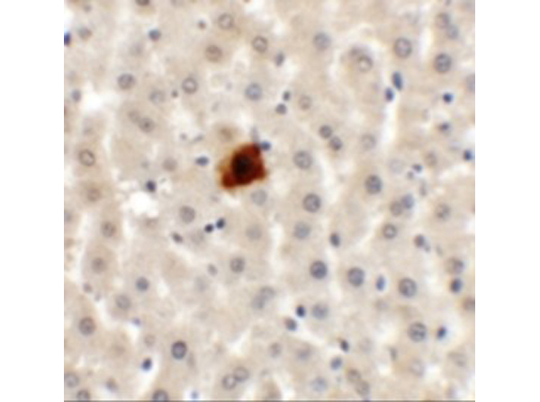 Immunohistochemistry of EI24