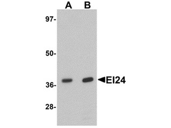 Western blot analysis of EI24
