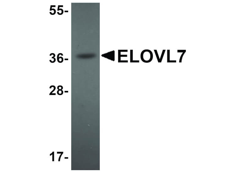 Western Blot of ELOVL7 Antibody