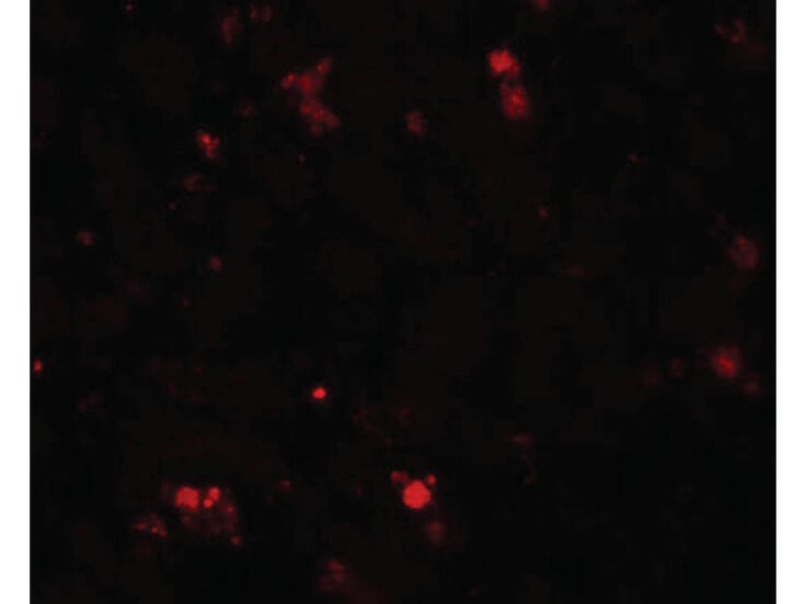 Immunofluorescence of ELOVL7 Antibody