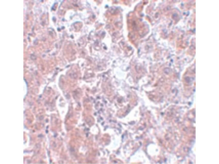 Immunohistochemistry of ELOVL7 Antibody