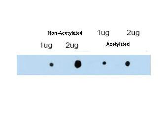 Anti-ATDC (Ac-K116) Antibody - Western Blot