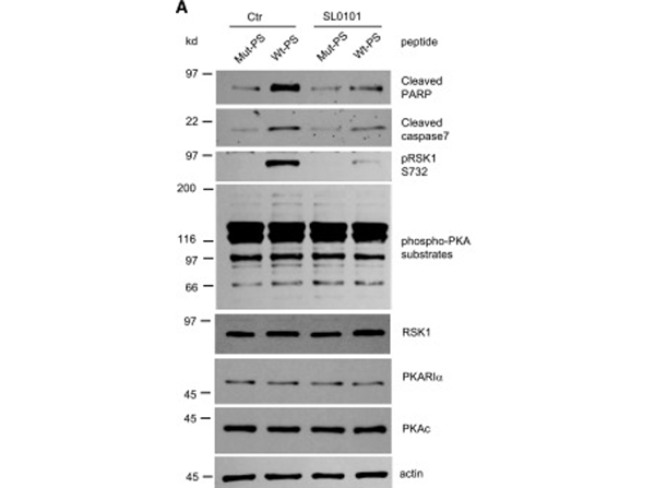 Western Blot using RSK1 pS732