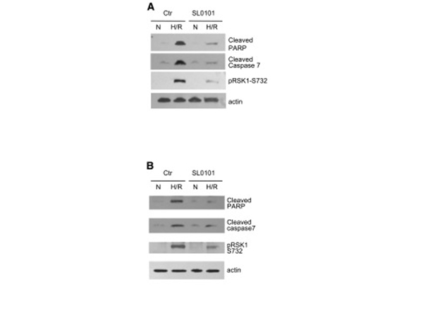 Western Blot using RSK1 pS732