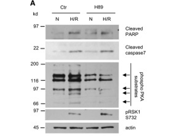 Western Blot using RSK1 pS732