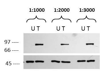 Western blot of RSK1pS732