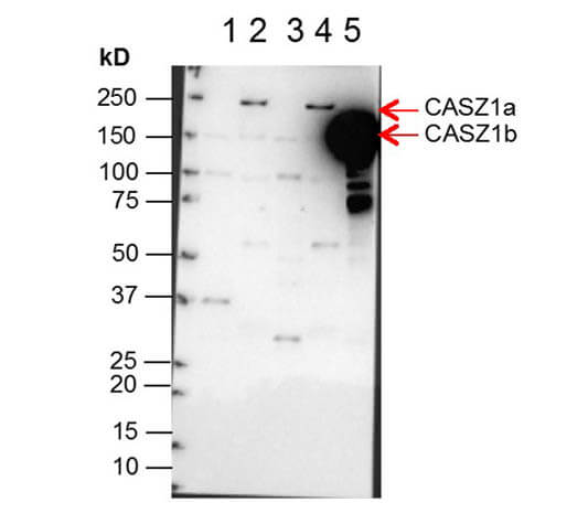 Western Blot of Anti-CASZ1 Antibody