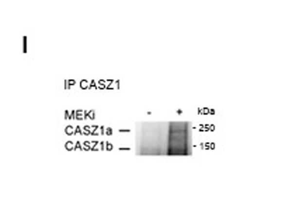 Immunoprecipitation using Casz1