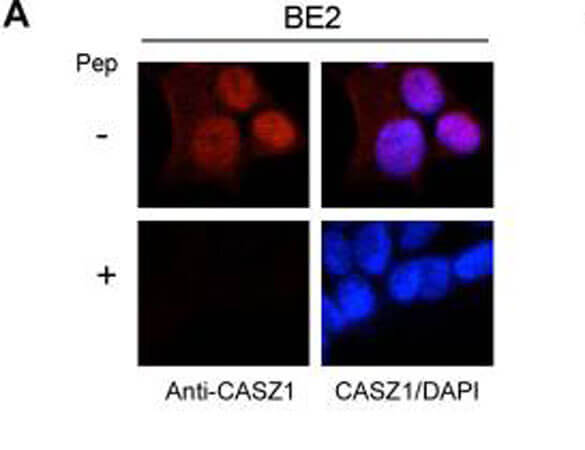 hCASZ1 Immunofluorescence
