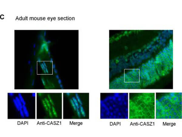 CASZ1 Immunofluorescence