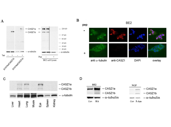 Immunofluorescence using Casz1