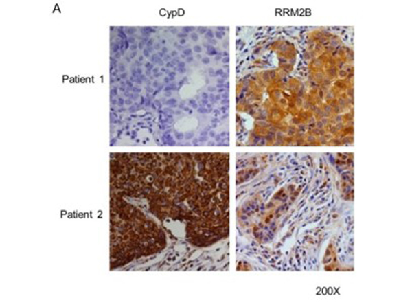 Immunohistochemistry using RRM2B