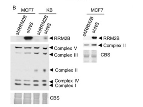 Western Blot using RRM2B