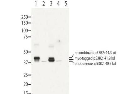 Anti-RRM2B antibody - Western Blot