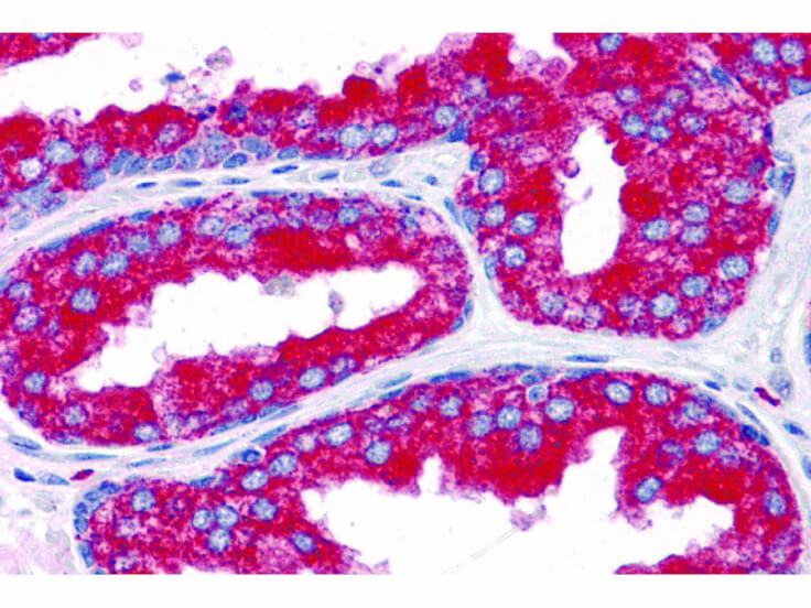 Immunohistochemistry of EMX2 Antibody