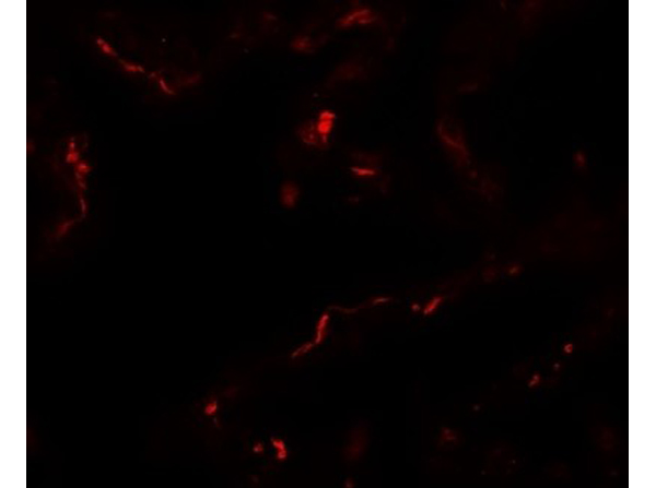 Immunofluorescence of EMX2