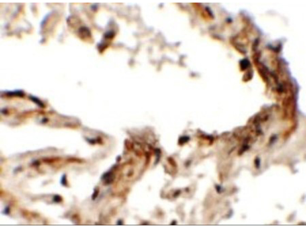 Immunohistochemistry of EMX2