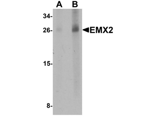 Western blot analysis of EMX2