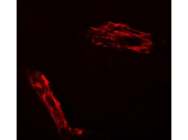 Immunofluorescence of EPAC1
