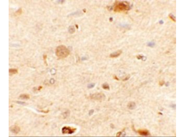 Immunohistochemistry of EPAC1