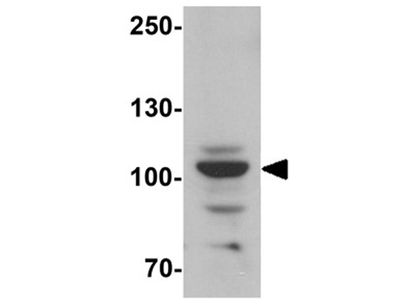 Western blot analysis of EPAC1