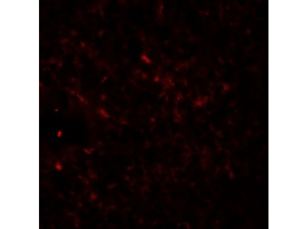 Immunofluorescence of EPAC2