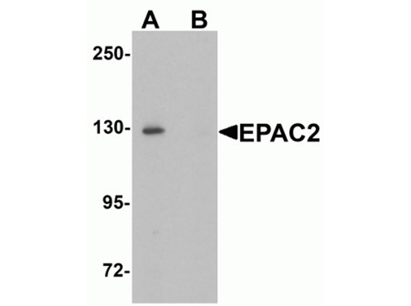 Western blot analysis of EPAC2