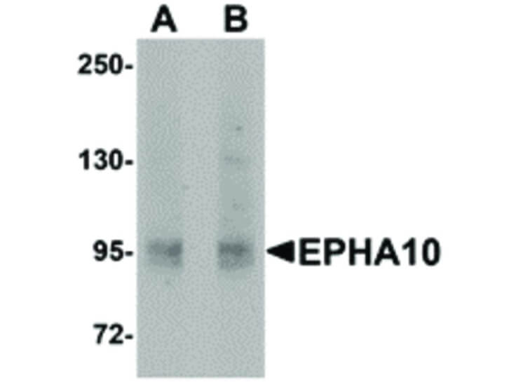 Western Blot of EphA10 Antibody