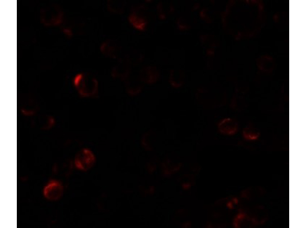 Immunofluorescence of EPM2A