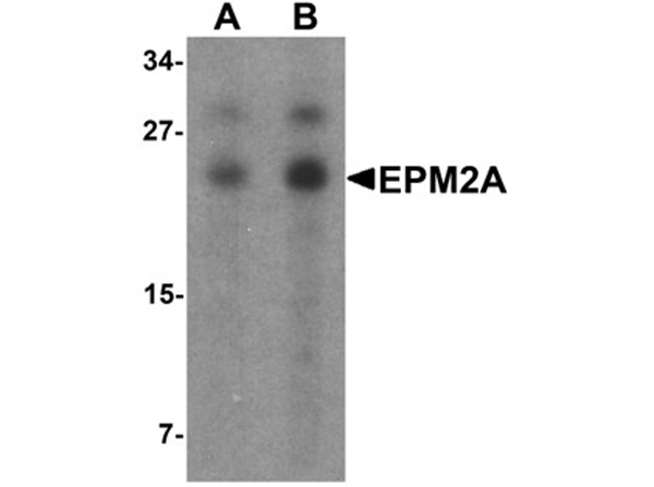 Western blot analysis of EPM2A