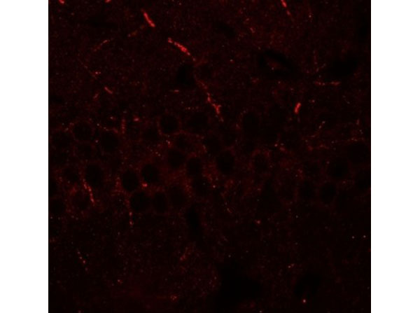 ERAP1 Antibody
