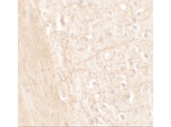 Immunohistochemistry of ERAP1