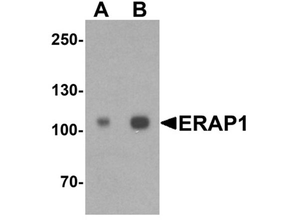 Western blot of ERAP1