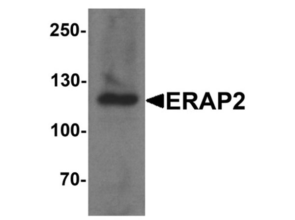 ERAP2 Antibody