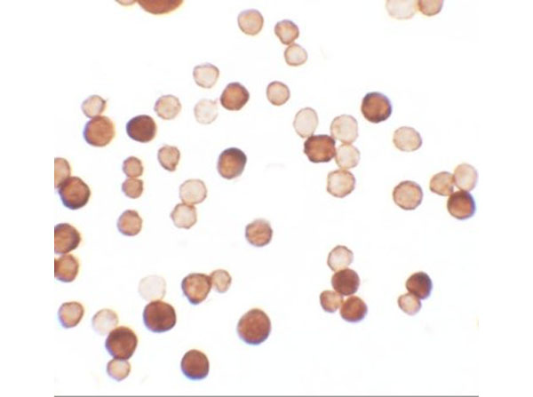 Immunocytochemistry of ERRF
