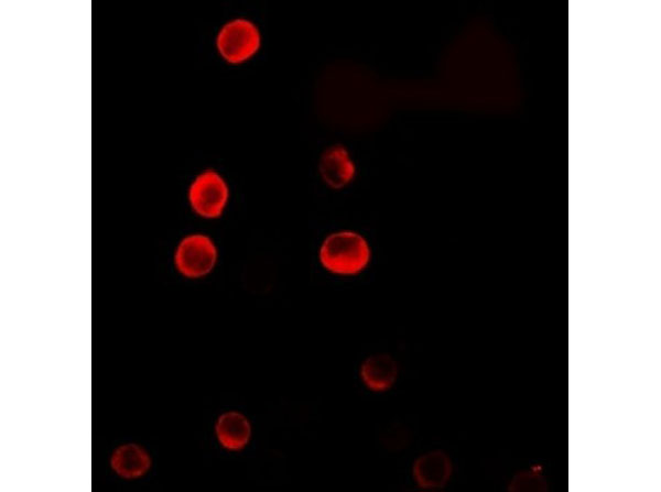 Immunofluorescence of ERRF