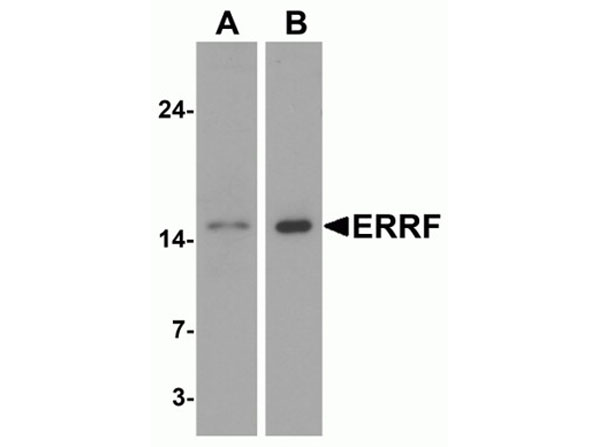 Western blot analysis of ERRF