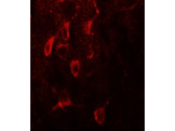 Immunofluorescence of ESR1