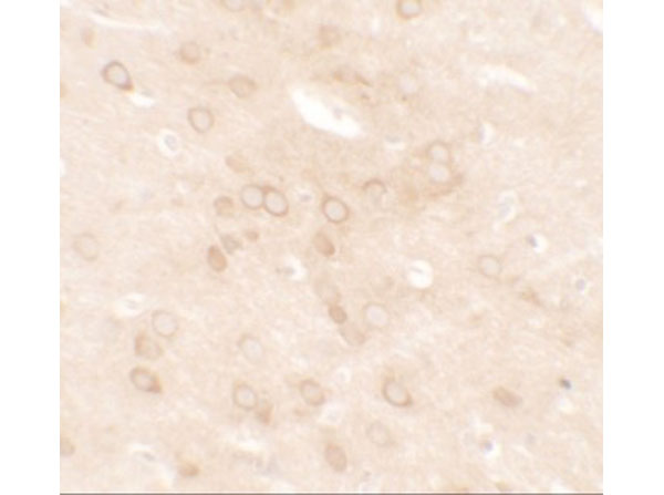 Immunohistochemistry of ESR1