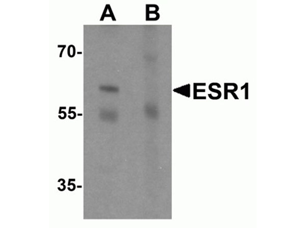 Western blot of ESR1