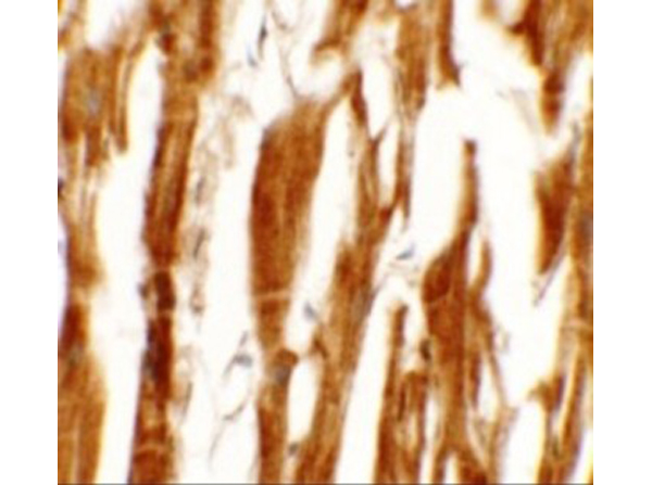 Immunohistochemistry of ESRRB