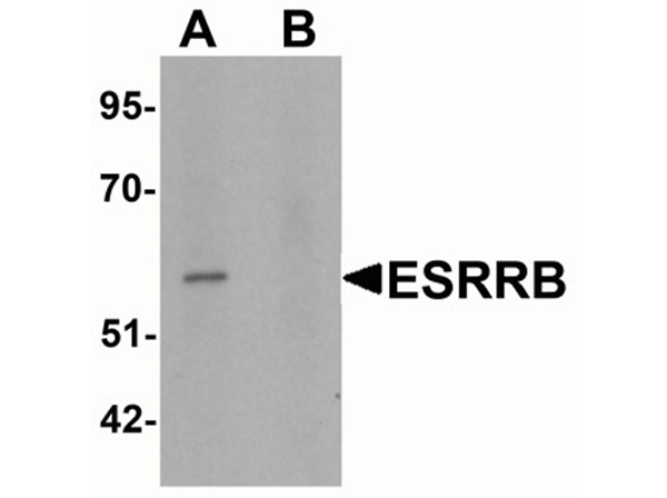 Western blot analysis of ESRRB