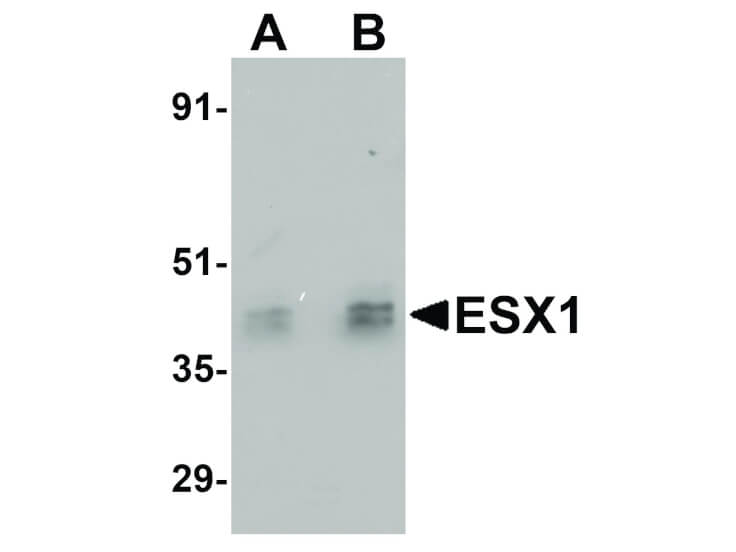 Western Blot of ESX1 Antibody