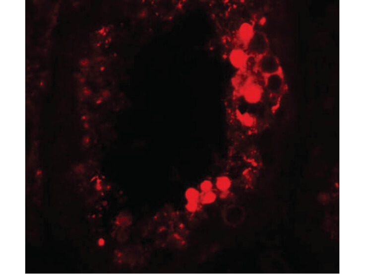 Immunofluorescence of ESX1 Antibody