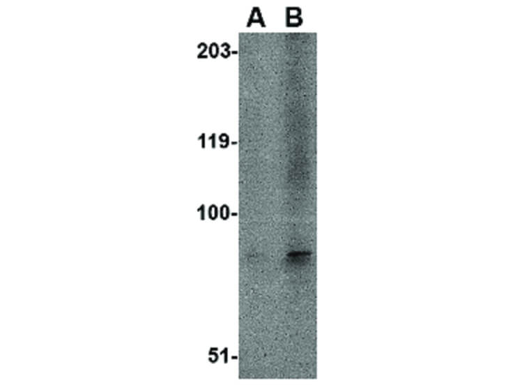 Western Blot of EVER1 Antibody