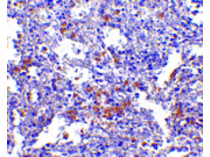 Immunohistochemistry of EVER1 Antibody