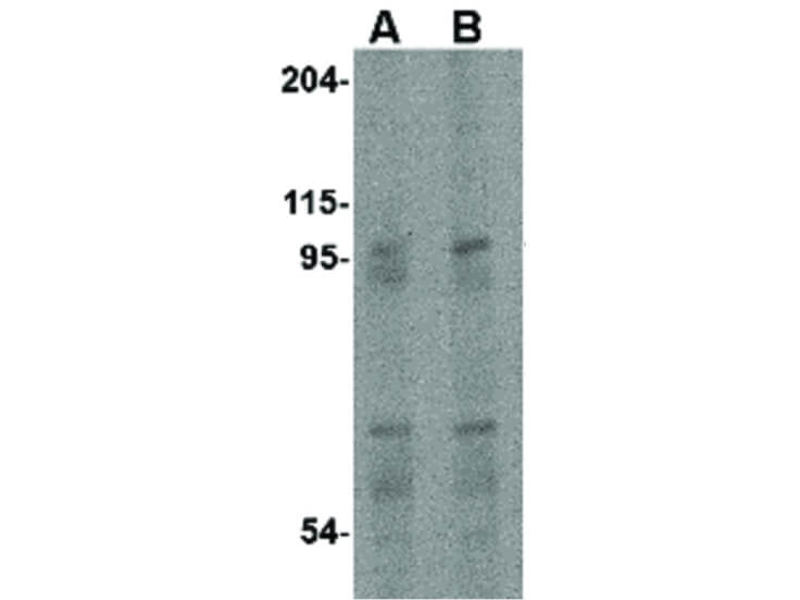 Western Blot of EVER1 Antibody