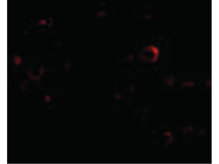 Immunofluorescence of EVER2 Antibody