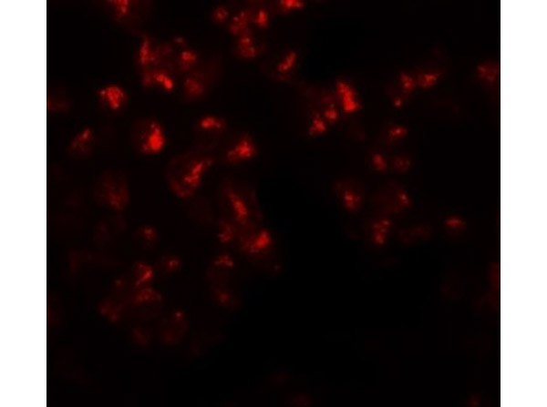 Immunofluorescence of EZH2